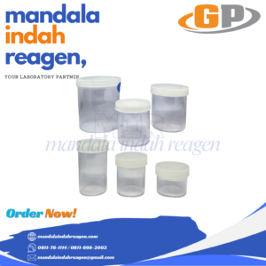 GP - Urine cup Container Lokal 10ml, 20ml, 30ml, 50ml, 100ml, 200ml, 500 ml