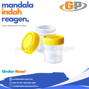 GP - Urine Cap (yellow) Non Steril