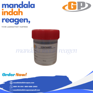 GP - Urine Cup Non Steril (red)