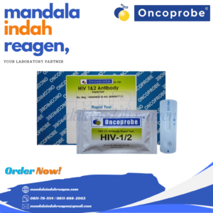 ONCOPROBE - HIV 1&2 Antibody