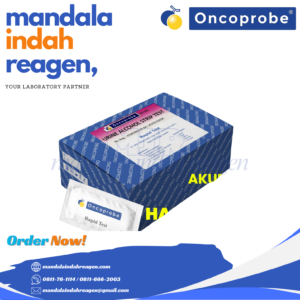 ONCOPROBE - Urine Alcohol